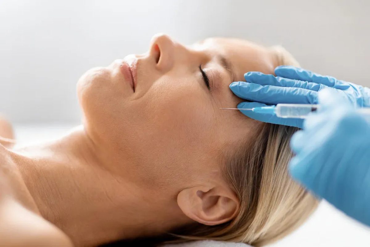 Sculptra collagen stimulator