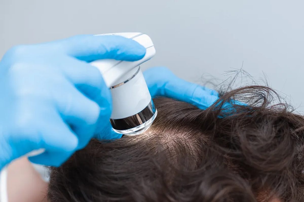 Hair Restoration